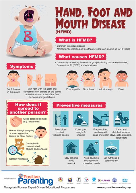 hand foot mouth disease icd 10 Hand, Foot, and Mouth Disease (HFMD) 11