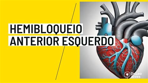 hemibloqueio anterior esquerdo e perigoso  qual a fisiopatologia da icfer? reduÇÃo no volume sanguÍneo por distÚrbio primÁrio na ejeÇÃo ventricular