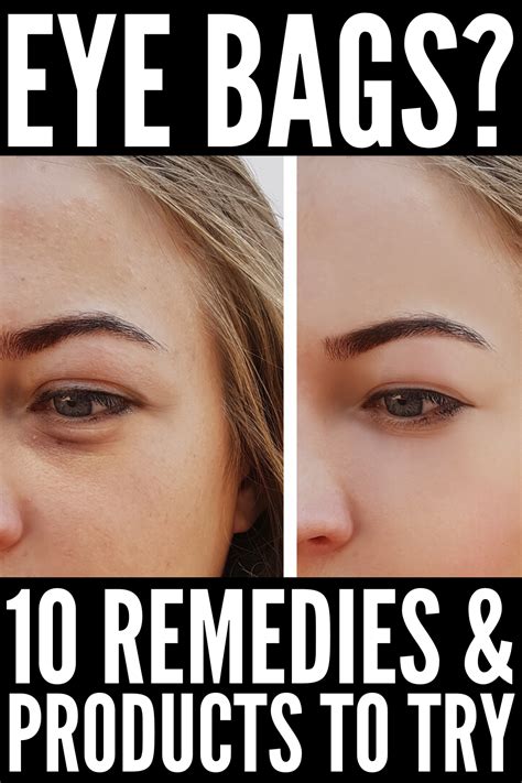 hwo to get rid of eye bags  Wrinkles under the eye may develop as the skin ages, due to it losing the ability to renew itself