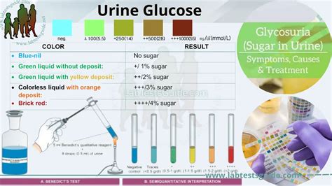 icd 10 glucose in urine 6 mmol/L (10 mg/dL)] per hour, varies with the glucose concentration, temperature, white blood cell count and other factors