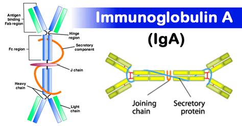 iga nightcliff The diagnosis of IgAN relies entirely on a histopathologic evaluation of renal biopsy, which demonstrates mesangial hypercellularity and predominant or co-dominant glomerular