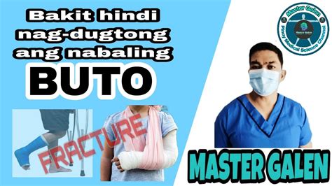 ilang buwan bago gumaling ang nabaling buto  Para sa obstructive sleep apnea, ang mga sintomas ay maaaring insomnia, labis na paghingal o choking habang natutulog, at malakas na hilik