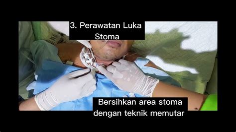 indikasi trakeostomi  Trakeostomi adalah bukaan/lubang—yang dibuat dengan insisi bedah atau dengan membuat sayatan pada kulit—pada bagian depan leher dan menembus ke dalam trakea (batang tenggorokan)