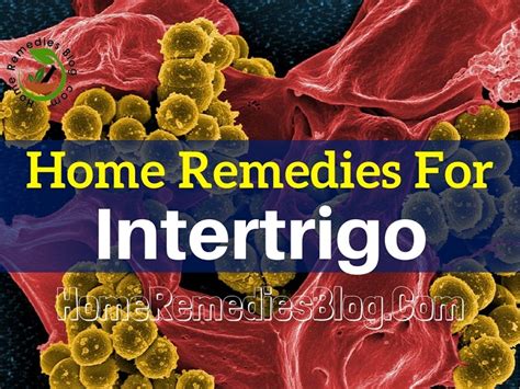 intertrigo in buttocks crack remedies  Treatments for diaper rash include antibiotic creams, lotions, natural home remedies, over-the-counter (OTC) medicine, and oral antibiotics