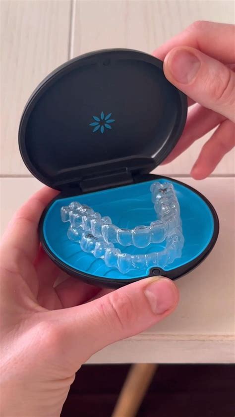 invisalign x sousmile Most treatment plans take between 12 and 18 months