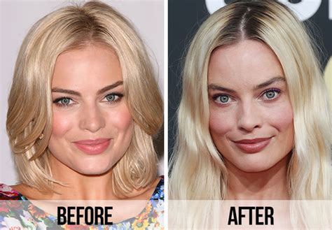 margot robbie bucal fat removal The first 1,000 people to use my link will get a 30 day free trial of Skillshare!Fat RemovalIn this video we will discuss