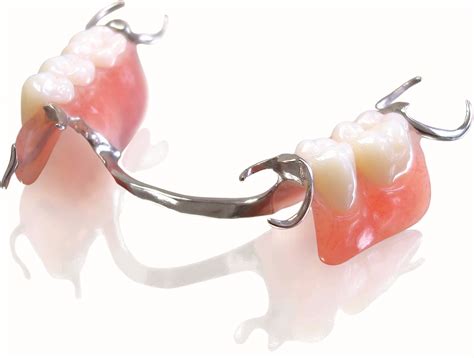 marylebone partial dentures 4 min read