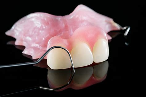 marylebone partial dentures  This advanced compound is injected under high pressure and then heat-cured into a personalized form developed for each individual patient