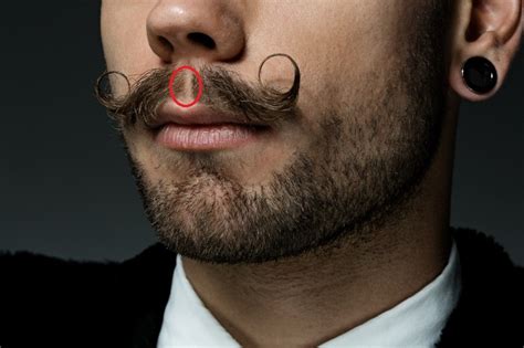 mustache gap under nose •Go for meditation to reduce stress ,nourish endocrine glands,