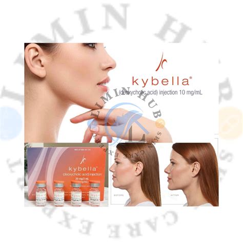 navarre kybella injections  It is the first and only FDA-approved injection to improve the appearance of moderate to severe sub-mental fullness