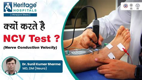 ncv test indio  EMG and NCV Facial Nerve Cost in Delhi