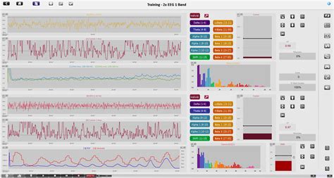 neurofeedback berlin  The neurofeedback group had a higher change in their alpha rhythm, but the sham group also changed, mainly through the attentional processes involved during the activity of neurofeedback