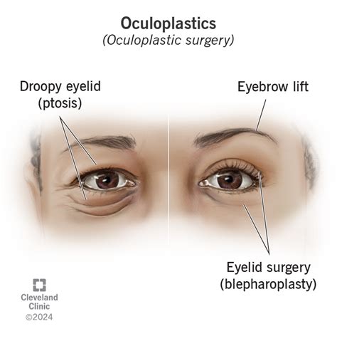 oculoplastic procedures near graton  During the consultation, Dr