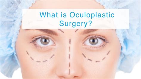 oculoplastic procedures near graton  Oculoplastic surgery can correct deformities and abnormalities, and can also