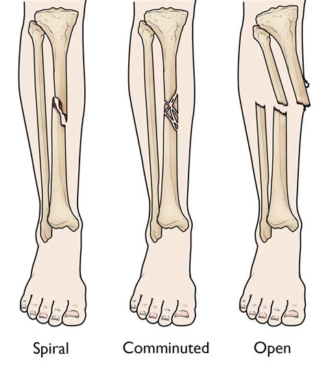 ottokar tibia  Wyjdź z południowo-zachodniego wyjścia i idź na wschód pod mostem, a następnie na północ wzdłuż ścieżki