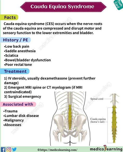 patofisiologi low back pain  Low Back Pain Subakut, telah dirasakan minimal 5-7 minggu, tetapi tidak lebih dari 12 minggu