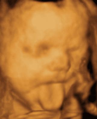 peek a baby 4d scan  Neither type of scan is harmful to you or