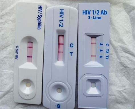 pemeriksaan hiv metode rapid test  diperiksa dengan uji reagen pertama, uji