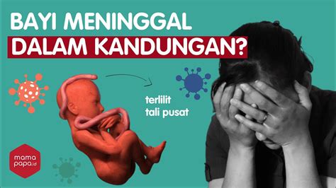 penyebab bayi meninggal dalam kandungan  Ibu harus mempersiapkan dirinya untuk sebuah prosedur melahirkan