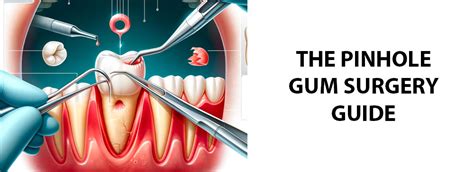 pinhole gum surgery victoria  Through this pinhole, special instruments are used to gently loosen the gum tissue