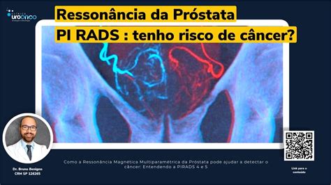 piroxicam serve para dor nas costas  A complexidade de qualquer dor aguda ou dor lombar crônica, e de volta, em geral, é muitas vezes diagnosticada como “dor nas costas não específica”; ou seja, dor nas costas, mas realmente não se sabe muito bem o por quê