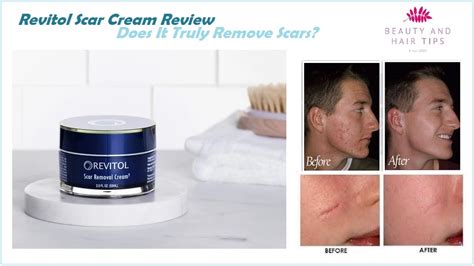 revitol scar cream review 0 out of 5 stars 1