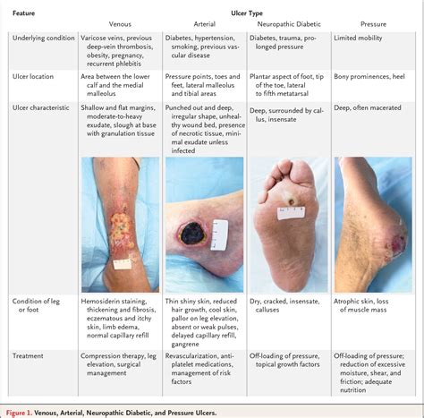 right toe ulcer icd 10 7 Cellulitis of foot 