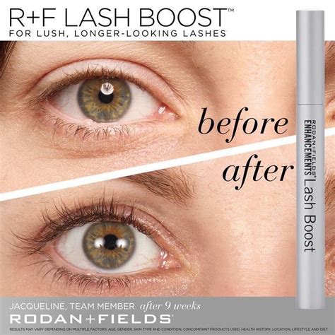 rodan and fields promo code  To all deals-hunters, seize the opportunity