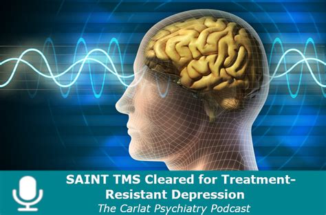 saint tms for depression in northgate  Transcranial magnetic stimulation (TMS) is a treatment for major depressive disorder