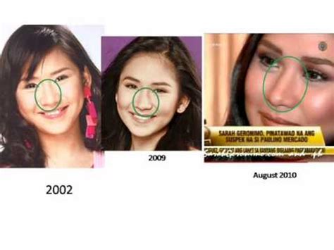 sarah geronimo nose job Sarah Geronimo is one of the most influential and successful singers and actresses in the Philippines and Southeast Asia