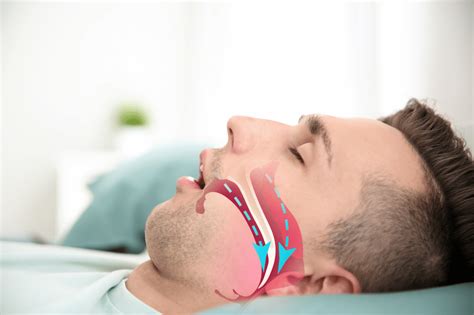sleep apnea aiken sc  His office accepts new patients