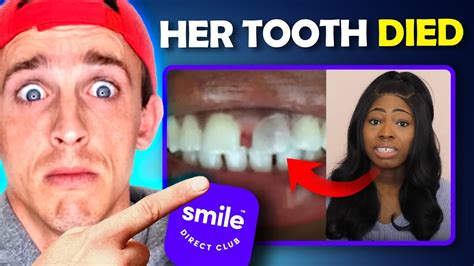 smile direct club horror stories  Best Custom Whitener: Smile Brilliant Teeth Whitening Trays