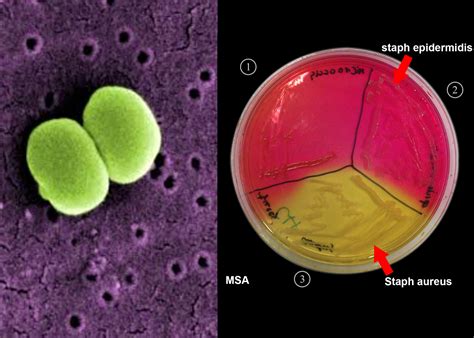 staphylococcus epidermidis icd 10 6 is a billable/specific ICD-10-CM code that can be used to indicate a diagnosis for reimbursement purposes