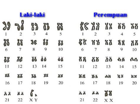 susunan kromosom yang dimiliki oleh sel tubuh manusia adalah id - Kromosom pada tubuh manusia berjumlah 46 yang terdiri dari 23 pasang kromosom, Adjarian