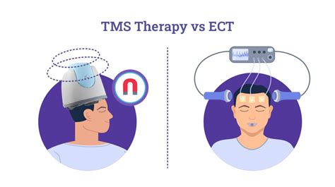 tms for depression in kitsap  Insurance