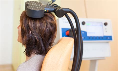 transcranial magnetic stimulation in mill creek  Ment Health Clin