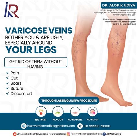 varicose veins waxahachie  stretch your legs and arms daily, preferablly do yoga