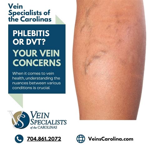 varicose veins waxahachie The most common venous diseases that a phlebologist treats are the following: varicose veins, spider veins, venous ulcers, and deep vein thrombosis