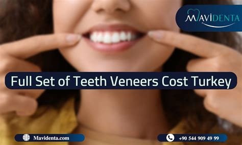 veneers cost denver co  A cost of living index above 100 means Denver, Colorado is more