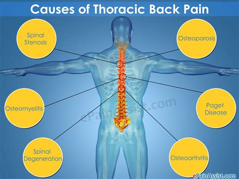 vertegra  Your spine is made up of vertebrae (bones), disks, joints, soft tissues, nerves and your spinal cord