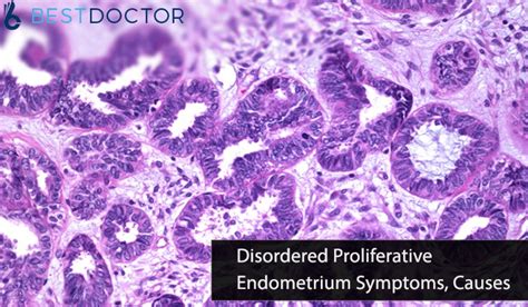 weakly proliferative endometrium meaning  Biopsy results may show cell changes linked to hormone levels, or abnormal tissues, such as fibroids or polyps