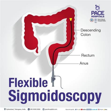 william holderman md  Abstract titled "Endoscopist and procedure-level factors associated with increased adenoma detection with the use of a computer-aided detection (CADe) device" receives award for outstanding research Dr