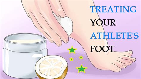 25 Home Remedies for Athlete