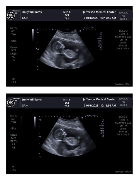 290+ Fake Ultrasound Pics Stock Photos, Pictures & Royalty-Free Images …