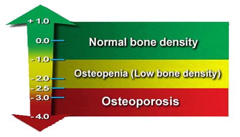 3 3 T Score Bone Density Free Download Bone Fractures Worksheet Answers - Bone Fractures Worksheet Answers