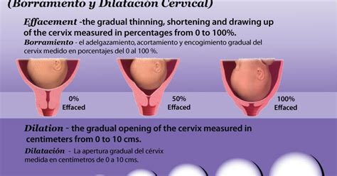 The cervix should be 100 percent effaced and 10 centimeters dilated before a vaginal birth. If you are 1 cm dilated or are 50 per cent effaced this means that your body has started getting ready for labor and delivery. In figure C the cervix is 60 effaced and 1 to 2 cm dilated. Ive been 1cm and 60 for 3 weeks now.. 