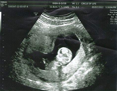 3 month ultrasound program. Things To Know About 3 month ultrasound program. 