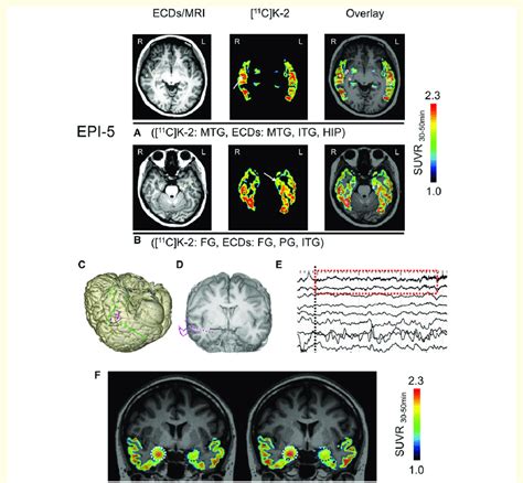 33sk soz.  B&ouml;l&uuml;m&uuml; Oyuncular: Tolga Sarıtaş, Serhat Kılı&ccedil;, Ayb&uuml;...