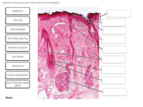 35 Label Skin Diagram Labels Design Ideas 2020