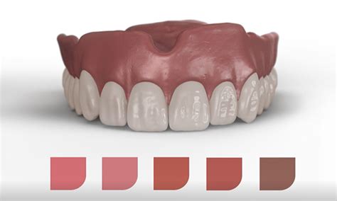 3D Printed Dentures: Strength, Color Stability & Aging Effects Revealed! (2026)